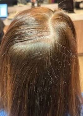 Cheveux forts, chute réduite, volume et éclat retrouvés, confiance renforcée.